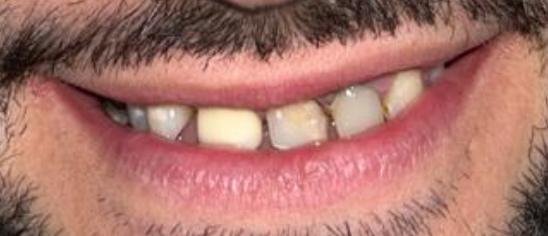 Cas d'èxit - Clínica Dental Raquel Arribas