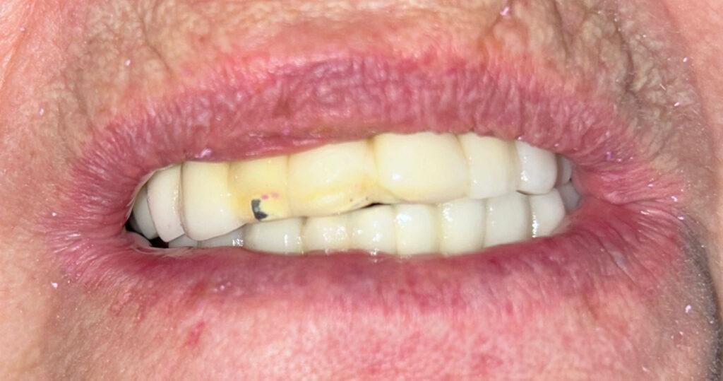 Cas d'èxit - Clínica Dental Raquel Arribas