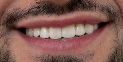 Cas d'èxit - Clínica Dental Raquel Arribas
