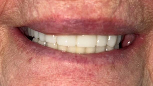 Cas d'èxit - Clínica Dental Raquel Arribas