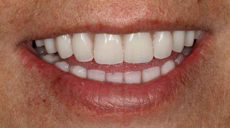 Cas d'èxit - Clínica Dental Raquel Arribas