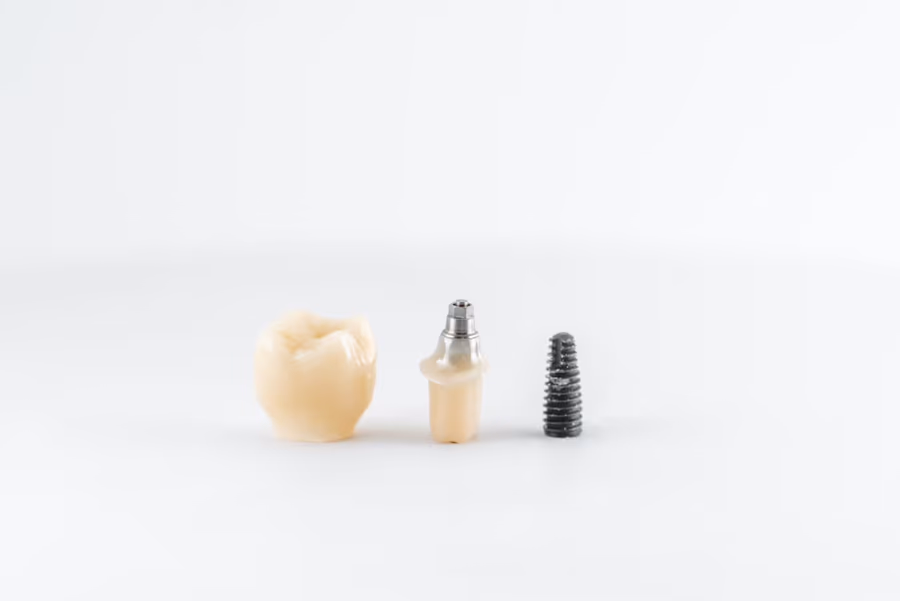 Implants Dentals