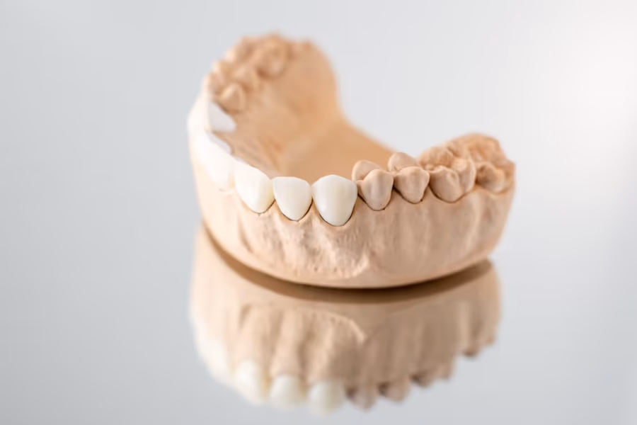 Pròtesis Dentals